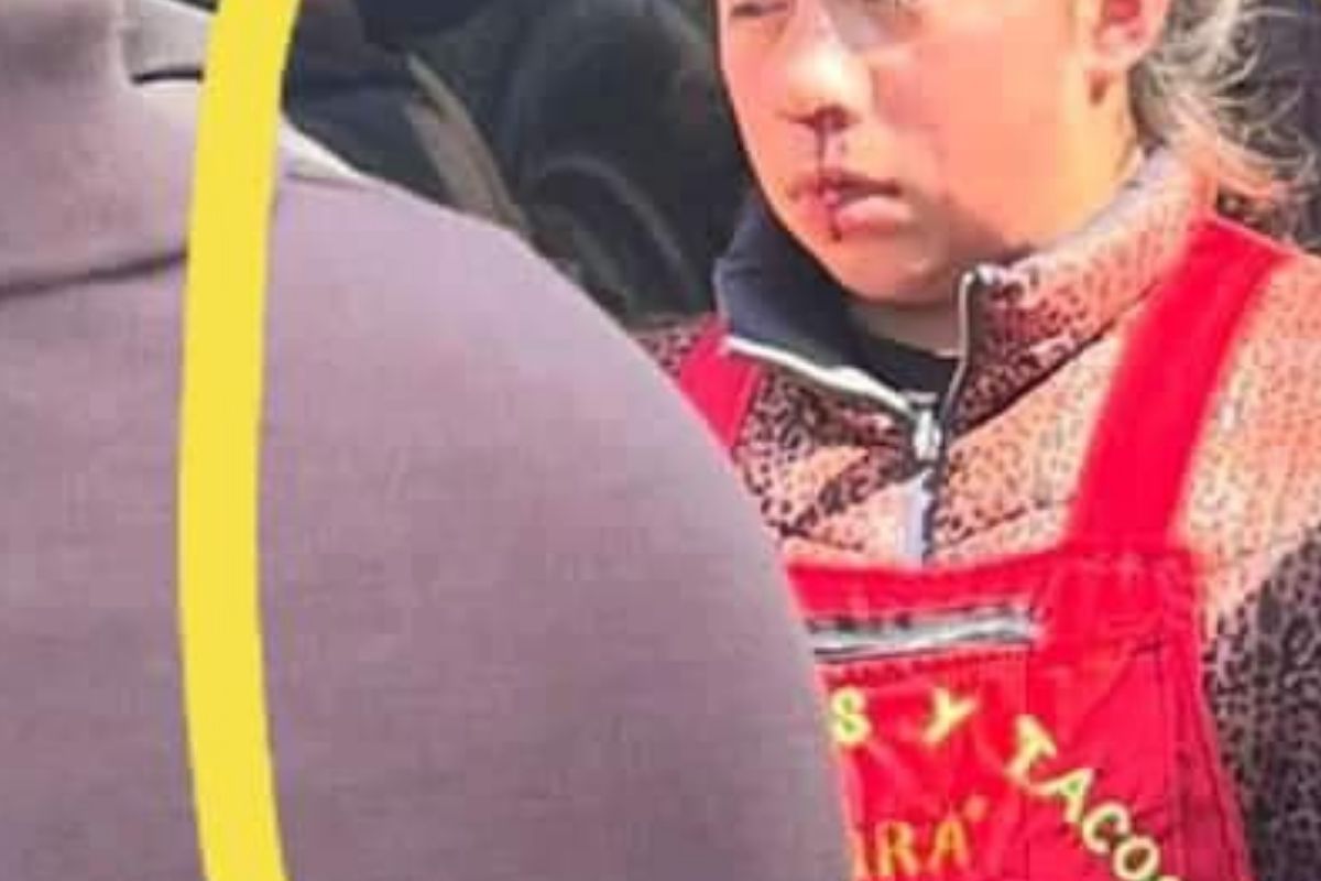 Mujer golpea a niña de 12 años por observar a su esposo; le rompe la nariz